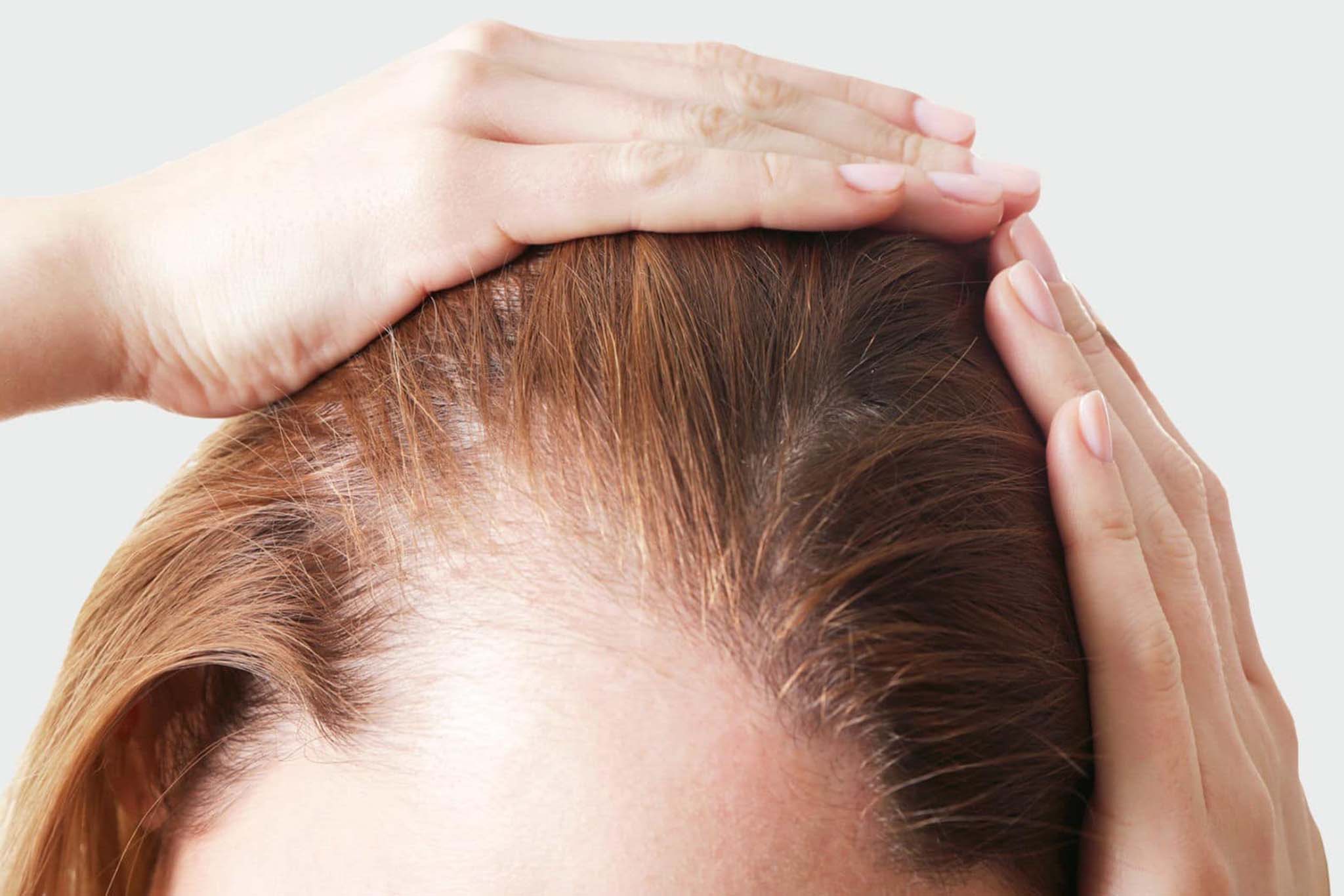 Protocole Alopécie & chute de cheveux